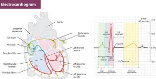 elektrokardiogram EKG