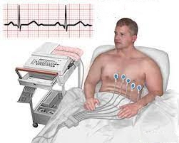 kako-se-izvodi-EKG EKG